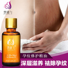 首发玄戒O3!小米18 Fold首销量同比上代增长300%
